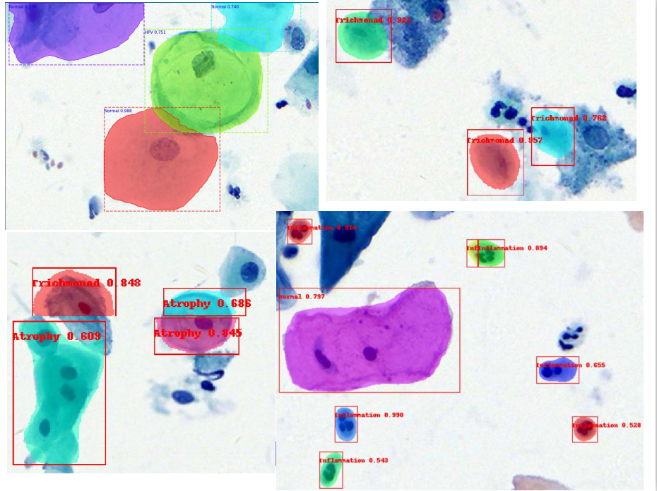 计算机算法什么是计算机算法？开云体育 开云官网的最新报道(图1)